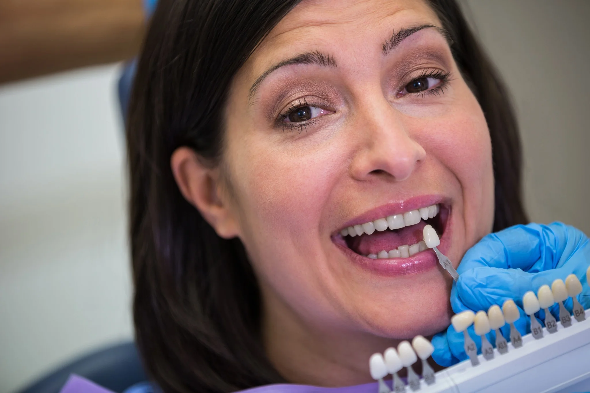 Same-Day Dental Crowns in Fresno, CA: Cost and What Changes It